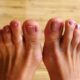 Dream Meaning of Toes